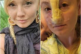 Woman's nose ripped off by pet dog scared of her teeth whitening