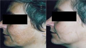 Norges største Permanent Makeupblogg