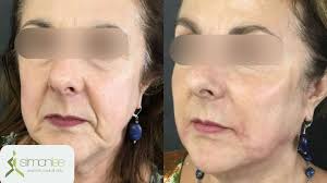 Simon Lee Aesthetic Medical Clinic