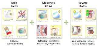 Von basics bis hin zu festmode: What To Do Staggered Therapy Ocular Surface Center Berlin