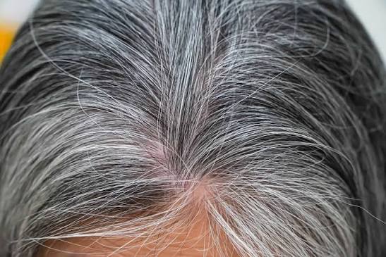Premature Greying of Hair: Causes and Prevention | ThriveCo