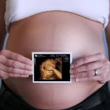 Especially if the practitioner doesn't offer this level of ultrasound testing. 1st Glimpse Inc 3d 4d Ultrasound 1stglimpseinc Twitter
