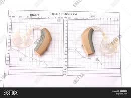 Audiology Image Photo Free Trial Bigstock