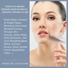Cara menghilangkan jerawat secara alami dan cepat bisa kalian coba sendiri di rumah tanpa harus mengeluarkan biaya mahal. Pin Di Cara Menghilangkan Bekas Jerawat