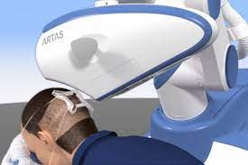 Artas Robotic Hair Restoration Haartransplantation Fur Geheimratsecken Und Glatzen