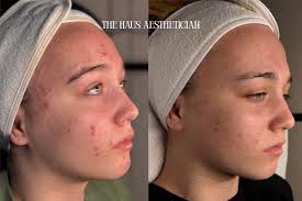 TAYLOR'd. Advanced Aesthetics