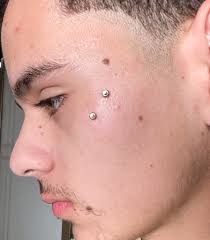 Walk ins welcome for more info (251)675-1359