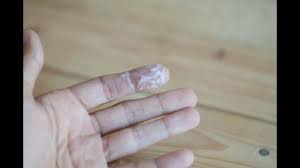 White discharge during or after ovulation? Pictures And Videos Of Cervical Mucus Ovulation Discharge Cervical Fluid Groove