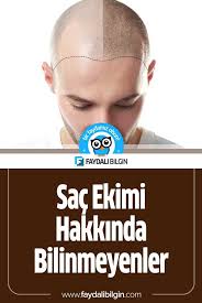 Sac Ekimi Hakkinda Bilinmeyenler Faydali Bilgin Sac Sac Dokulmesi Sac Bakimi