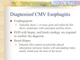 Differential diagnosis between herpes simplex virus (hsv) esophagitis and cytomegalovirus (cmv) esophagitis is challenging because there are many similarities and overlaps between their. Morning Report Jieli Li 12 29 Ppt Video Online Download