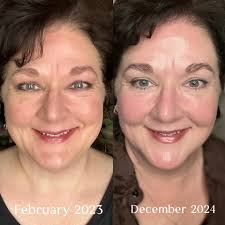12/26/2024 NOW at Holiday✨GLAM by DIOR💄@Dillards WHY THERE'S ONLY 1 See  the transformation. In just 7 days, you'll see more defined-looking  contours, smoother skin and visibly plumped lines and wrinkles. Our new