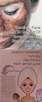 They can dry up the acne instantly without leaving and scars. Pin On Best List On Pinterest