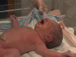 El Puntaje De Apgar Para El Recien Nacido Video Babycenter
