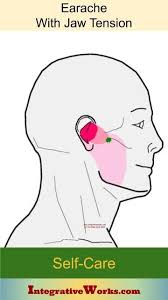 Self Care Earache With Jaw Tension Integrative Works In 2020 Trigger Points Tmj Temporomandibular Joint