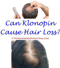 God's pharmacy was established long before minoxidil was discovered. Pin On Hair Loss Tips
