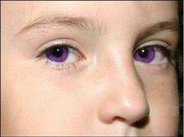 Can Someone Really Have Violet Colored Eyes No Elizabeth Did Not Have Violet Colored Eyes And The Girl In This Image I Rare Eyes Rare Eye Colors Violet Eyes