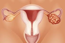 Start here to find information on ovarian cancer treatment, causes and prevention, screening, research, and statistics. Ellen Pompeo Offered Ovarian Cancer Advice And Real Doctors Weren T Happy About It