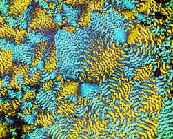 How does cholesterol travel around the body? What S The Difference Between Ldl And Hdl Cholesterol Howstuffworks