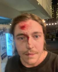 Ben Woolford's Instagram, Twitter & Facebook