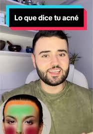 Tren Del Skin Que Significa