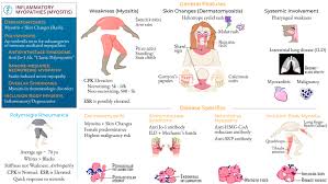 Image result for Polymyositis