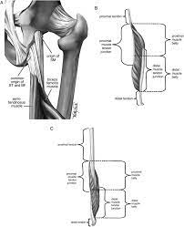 Patellar tendonitis (jumper's knee) is sometimes mistaken for quadriceps tendonitis due to the close working relationship within the soft tissues of the knee joint. Part A Proximal Hamstring Origin B Type I High Strain Download Scientific Diagram