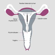 In den ersten monaten nach dem einlegen sind zwischenblutungen häufig, danach verschwinden sie meist wieder. Ubersicht Hormonfrei Verhuten