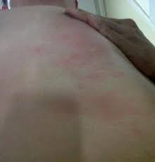 Klinik sepakat (taman lindungan) petaling jaya: Klinik Sentral In Sri Petaling Kuala Lumpur Malaysia Not Truly Asia Flamindevil