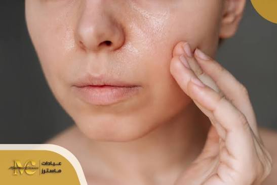 البشرة الدهنية: أسبابها، مشاكلها، وأسرار العناية الصحيحة - عيادات ماسترز الطبية