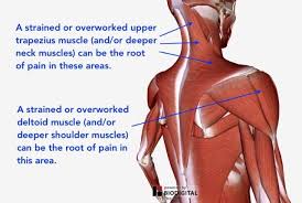Right above my shoulder blade teading to the back of my neck. Understanding Shoulder Pain Neuromuscular Therapy Of Vermont