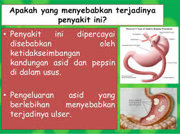Sedang mencari produk investasi yang tepat? Esp Shaklee Ikhtiar Bajet Untuk Gastrik Tidak Berulang Shidarahmat