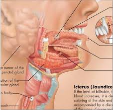 Diseases Of The Digestive System Chart Vr1431