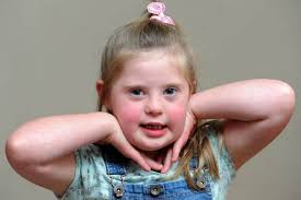 The world would be a much poorer place without people with Down's Syndrome  like amazing Lola'