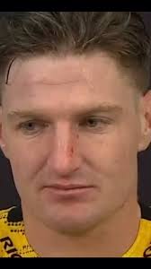 Poor Jordie. #superrugby #unlucky #fyp #allblacks