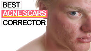 Acne scar treatments are best handled with special attention and care from your dermatologist since they require more. 10 Best Dark Spot Correctors For Acne Scars 2019 Youtube