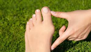 Hallux Valgus Wenn Der Grosse Zeh Schief Liegt Gesuendernet Ratgeber Fur Gesundheit Medizin Und Krankheiten