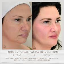 Non Surgical Facial Rejuvenation Dr. Nicole is a double board-certified  cosmetic surgeon. She has many anti aging options for the face. Call or  text to get a consult 918-939-8339 #NonsurgicalRejuvenation  #FacialRejuvenation #YouthfulGlow #