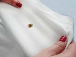 Bazı pas lekeleri de hafif yeşil tonlarında ve küf görünümünde olabilmektedir. Eldivenler Jabeth Wilson Tazmin Etmek Pas Lekesi Kazaktan Nasil Cikar Yenikoskesraotel Com