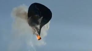 歯医者は苦手だけどお姉さんは好き