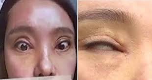 We did not find results for: Woman Rips Out All Her Eyelashes After Her Hand Accidentally Slipped While Using Lash Curler World Of Buzz