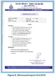 A Case Of Left Mammary Fibroadenoma Successfully Cured By Homoeopathic Therapy