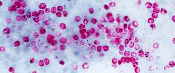 Cryptosporidium parvum is a protozoan and an obligate intracellular parasite (a parasite that cannot survive without a host) that commonly causes an opportunistic infection in immunocompromised hosts. Cdc Warns Of Pool Parasite This Summer Abc News
