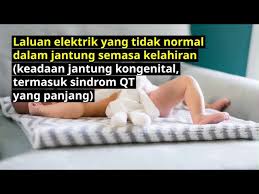 Mungkin ada juga yang yang paling besar prosentase orang dengan jantung berdegup kecang karena ketakutan yang sangat. Jantung Berdegup Laju Rapid Heart Beat Penyebab Doctoroncall