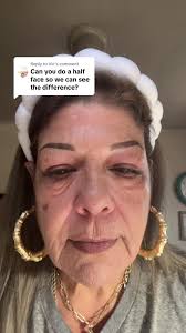 Peter Thomas Roth Skincare: Face Tightening Solutions