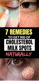 Black And White Spots On Tonsils 7 Natural Remedies To Get Rid Of Milk Spots In 2020 Natural Remedies Beauty Care