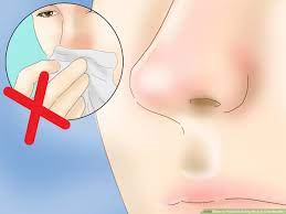 How To Prevent A Runny Nose In Cold Weather: 8 Steps
