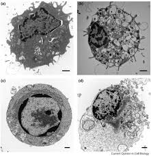 Check spelling or type a new query. Death By Design Apoptosis Necrosis And Autophagy Sciencedirect