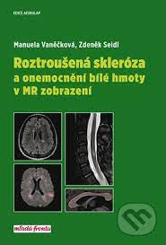 První data ukazují, že koronavirus pro ni není nebezpečnější. Roztrousena Skleroza A Onemocneni Bile Hmoty V Mr Zobrazeni Manuela Vaneckova Zdenek Seidl 2018 Pevna Vazba Cesky Jazyk Knihy Na Martinus Cz