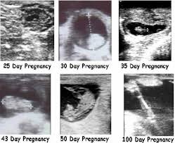 Bovine Pregnanacy