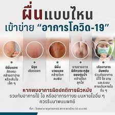 อาการโควิด 19 ที่นอกจากไข้ เหนื่อยหอบ ไอ มีอะไรที่บ่งชี้ว่าติด โควิด 19 บ้าง เพราะอย่างบางคนมีอาการจมูกไม่ได้กลิ่น ท้องเสีย ลิ้นไม่รับรส โดย. Usrc Ek Kja7dm